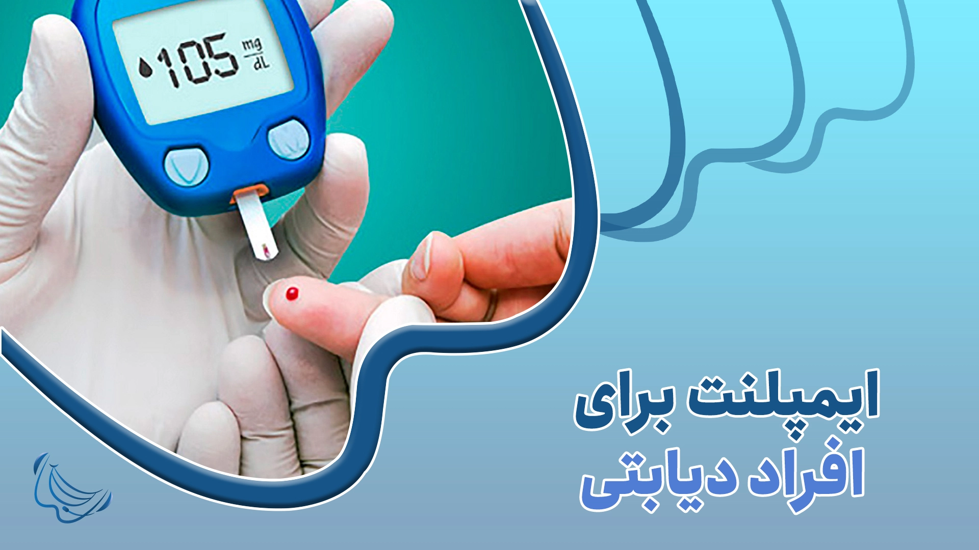 ایمپلنت برای افراد مبتلا به دیابت نوع 2