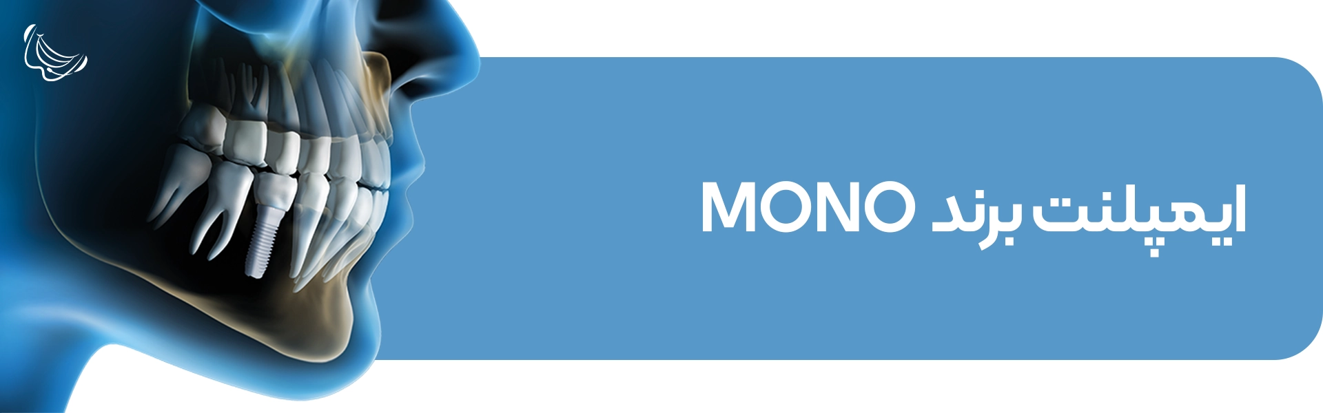 ایمپلنت برند Mono-Implant