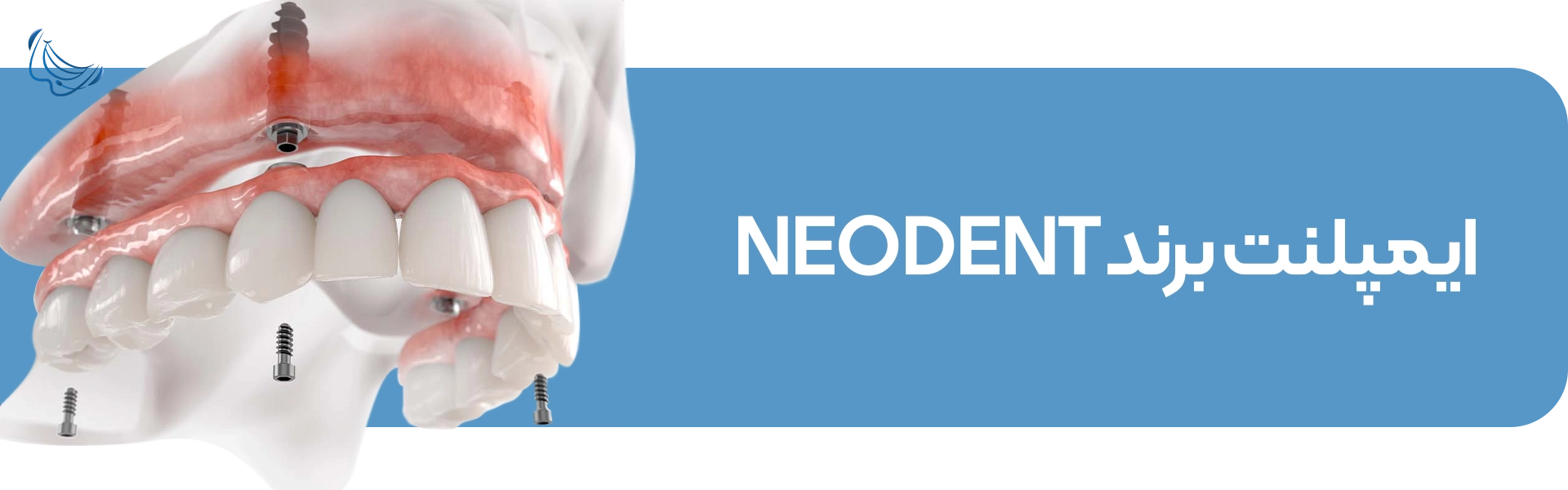 ایمپلنت برند Neodent