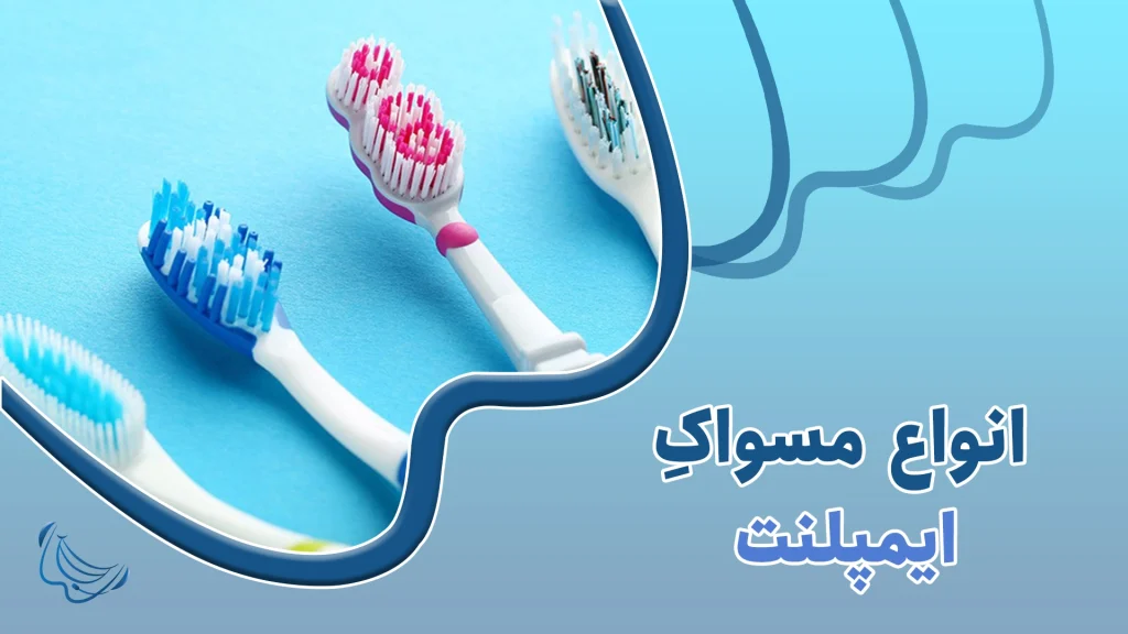انواع مسواک ایمپلنت