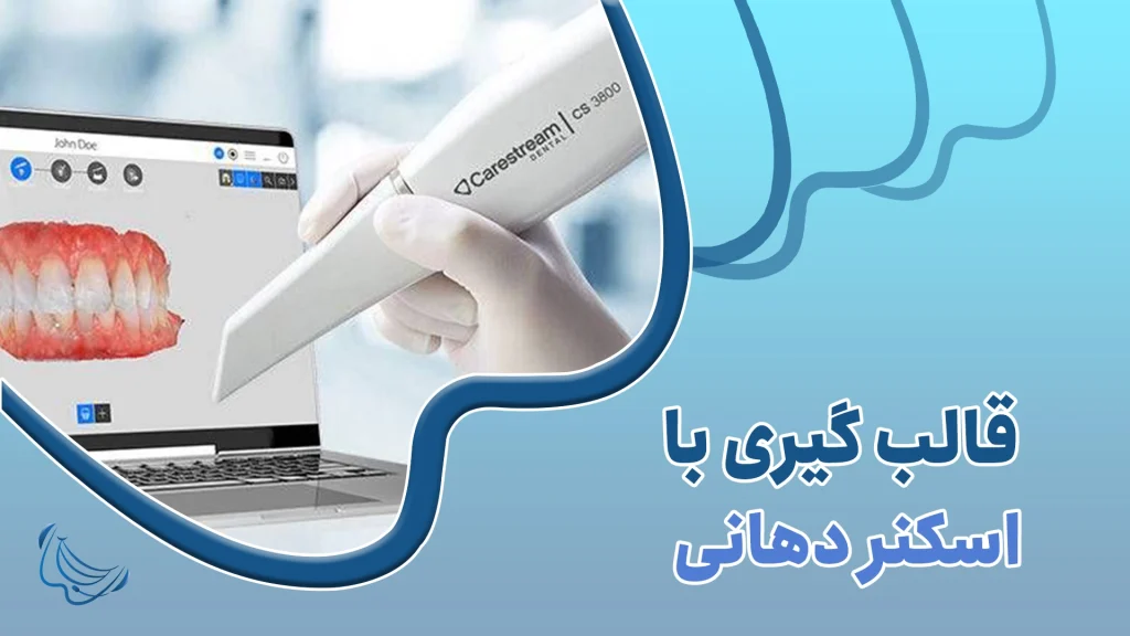 اسکنر داخل دهانی