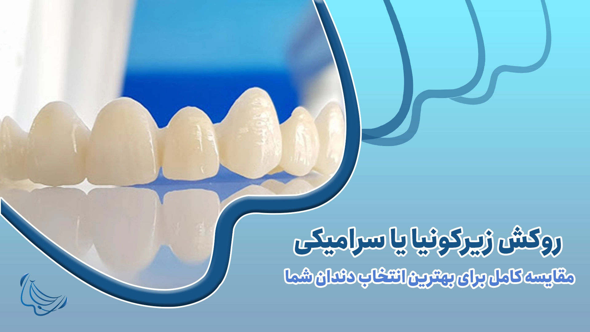 روکش زیرکونیا یا سرامیکی
