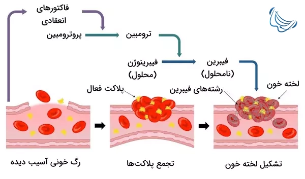 پلاگین فیبرینی