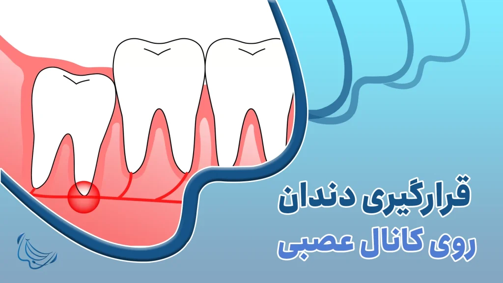 چرا بعضی دندان‌ها بی‌حس نمی‌شوند
